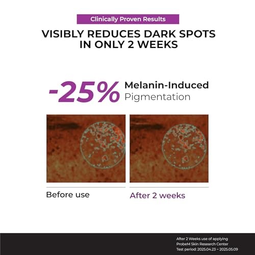 JUMISO Niacinamide 20 Serum - Korean Face Serum with Glutathione, TXA Tranexamic Acid and Centella Complex - Reduces Pigmentation, Uneven Skin Tone, P