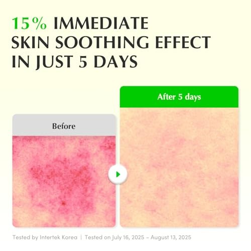 EQQUALBERRY - Aloe PDRN Calming Serum - 30ml