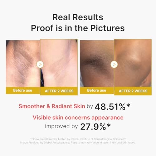 Medicube - Kojic Acid Turmeric Body Peel Shot - 280ml