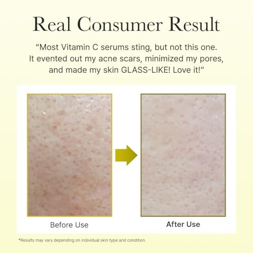 Arencia Vitamin C Booster Shot 30 Ml
