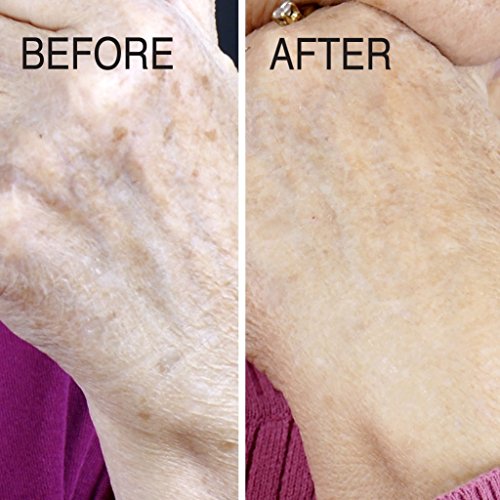 Advanced Clinicals Vitamin C Body Cream for Radiant Skin. 16 OZ
