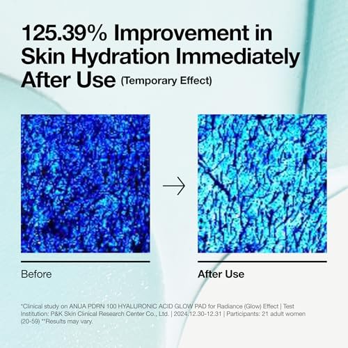 Anua 8 Hyaluronic Acid Catechin Calming Pad, Pore Care & Cooling Effect with Korean Toner Pad (185ml,110 Pads) (PDRN)